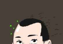 Revolutionizing Hair Restoration with FUE