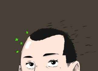 Revolutionizing Hair Restoration with FUE